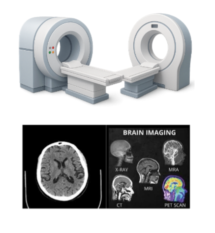 ตรวจภาพถ่ายสมองด้วย CT Scan